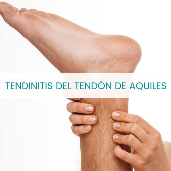 Tendinitis del Tendón de Aquiles: diagnóstico y pautas fisioterapéuticas