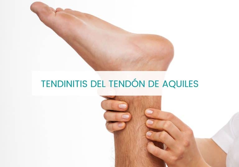 Tendinitis del Tendón de Aquiles: diagnóstico y pautas fisioterapéuticas