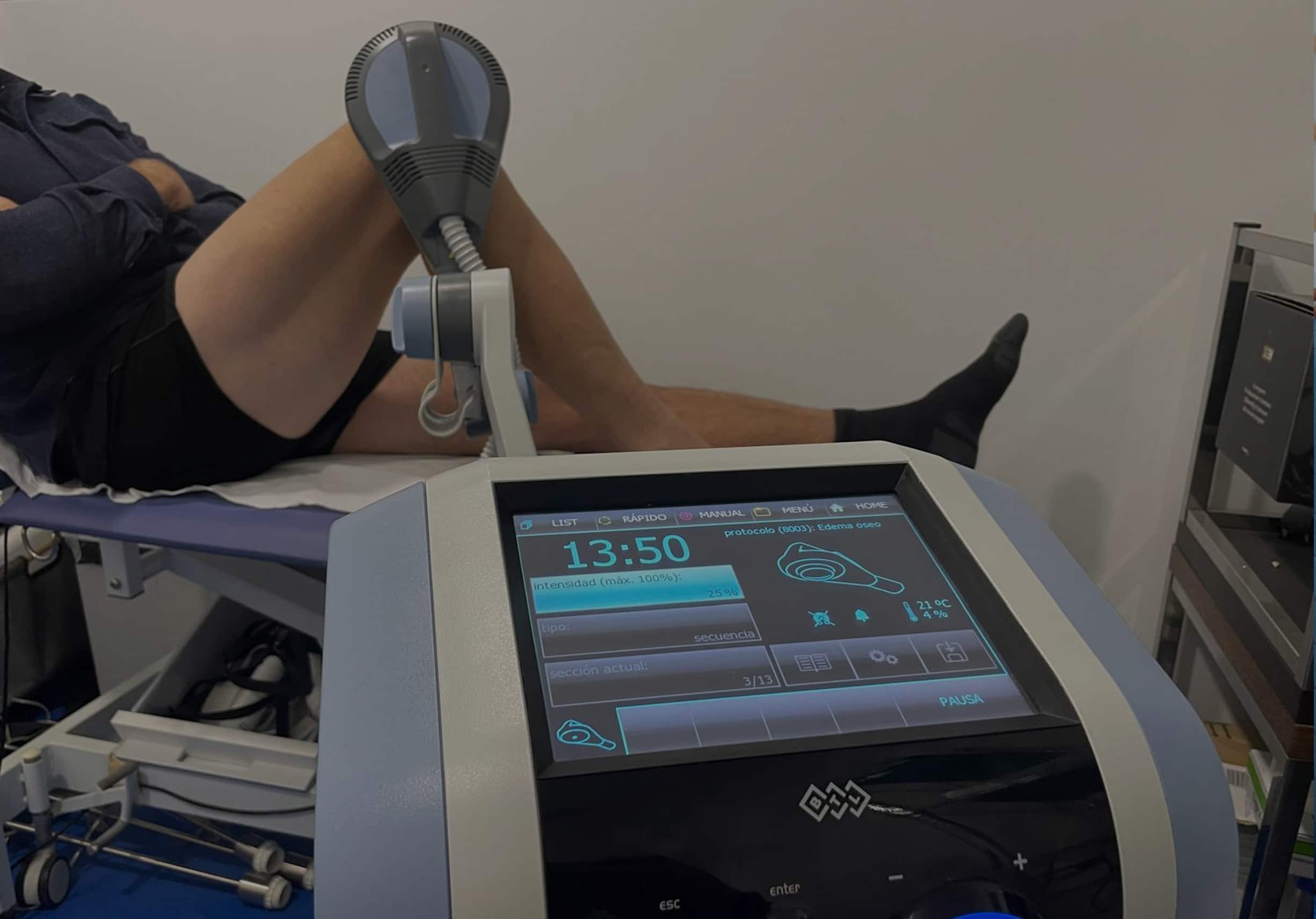 Edema óseo: qué es, por qué duele y cómo lo tratamos en IntegralFisio