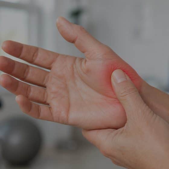 Rizartrosis o artrosis del pulgar cómo tratarla y frenar el dolor