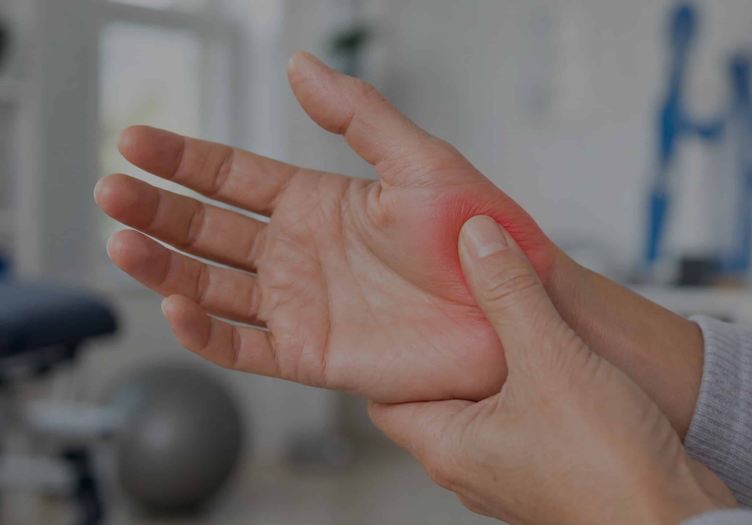 Rizartrosis o artrosis del pulgar cómo tratarla y frenar el dolor