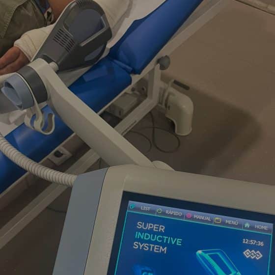 Magnetoterapia para fracturas en Vigo